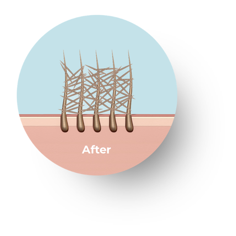 How the hair fibres change after use of toppik products