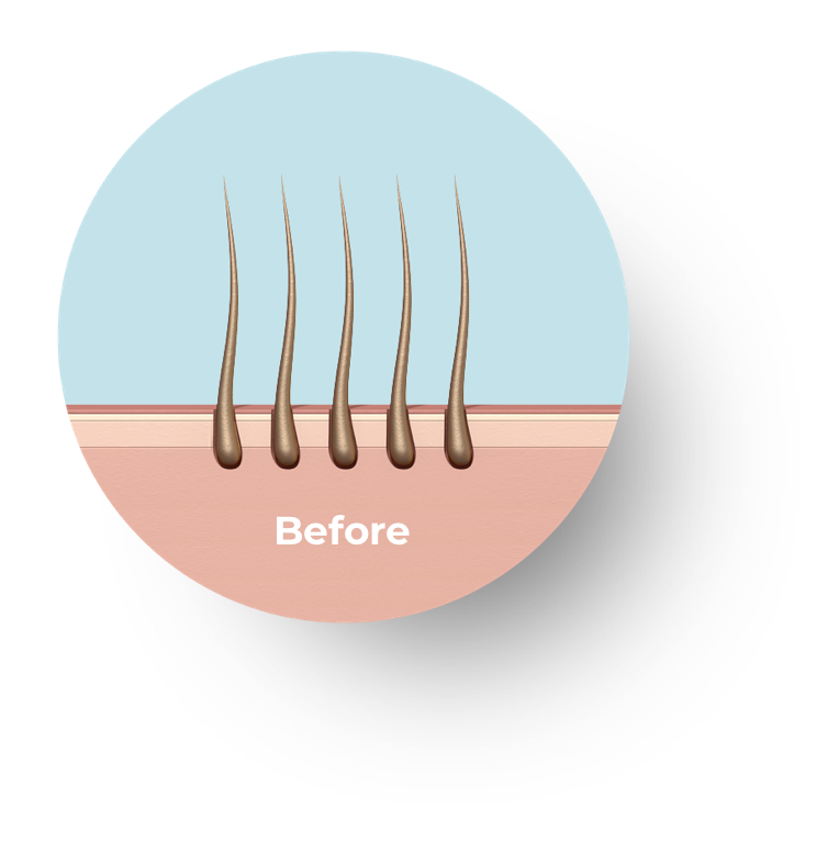 Picture of hair before applying hair fibers