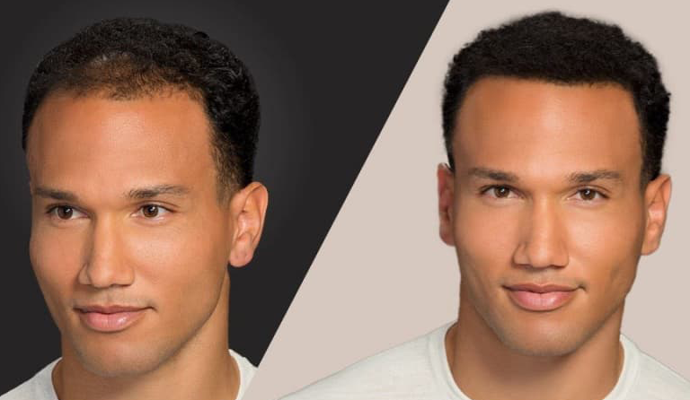 Toppik - Hair Fibers & Hair Loss Concealer Products Toppik - Hair Fibers & Hair Loss Concealer Products